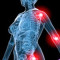 Muscle Pain & Injuries